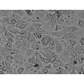 Monkey Hepatocytes, Stellate Cells, Kupffer Cells